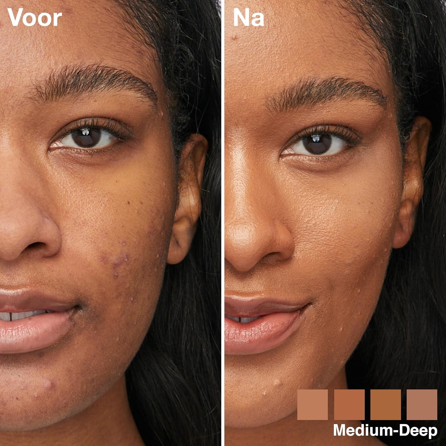 image:imageMaybelline New York 4in1 Make Up mit Concealer BB Cream Highlighter und Primer fr einen perfekten Teint Foundation mit leichter Deckkraft Instant Perfector Glow Nr 01 Light 20 mlNr 03 Medium Deep