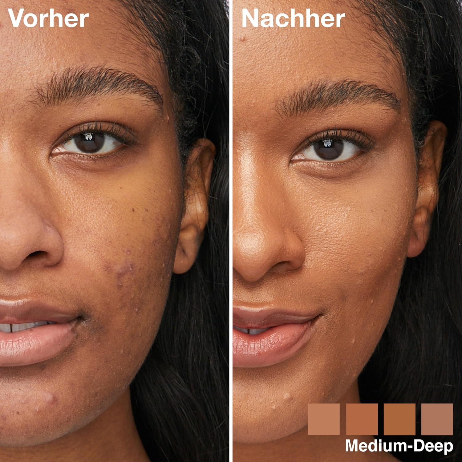 image:imageMaybelline New York 4in1 Make Up mit Concealer BB Cream Highlighter und Primer fr einen perfekten Teint Foundation mit leichter Deckkraft Instant Perfector Glow Nr 01 Light 20 mlNr 03 Medium Deep